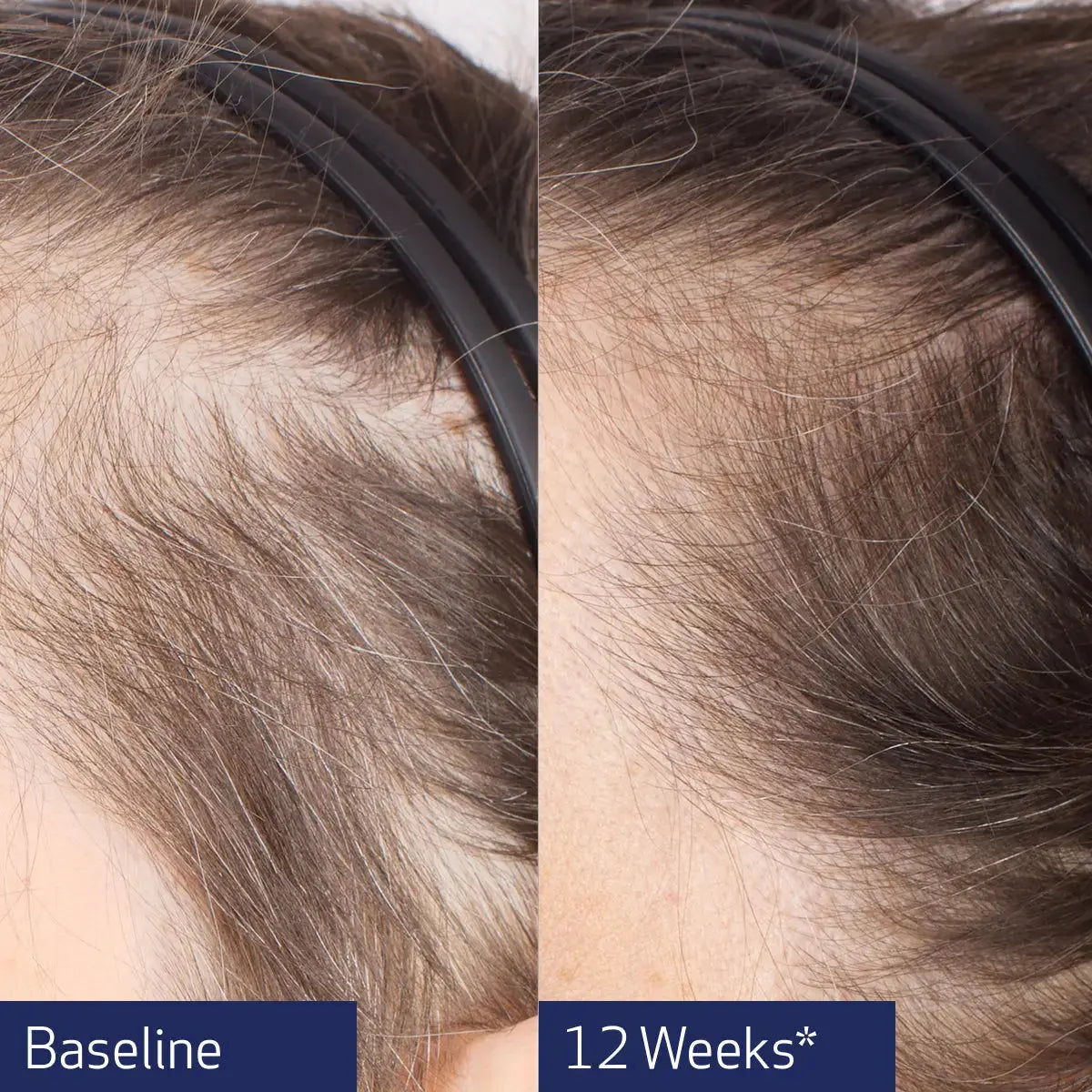 Obagi Nu-Cil® BioStim™ Scalp Serum 60ml